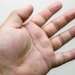 ما السبب وراء انتفاخ أصابع اليد عند الاستيقاظ؟
